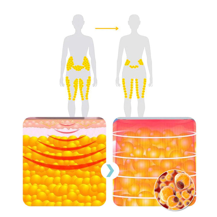 🔥ΤΕΛΕΥΤΑΙΑ ΜΕΡΑ - 70% ΕΚΠΤΩΣΗ) SlimolyTM Matteo Υπερηχητικό Βραχιόλι Body Shape Pro 🔥-GR