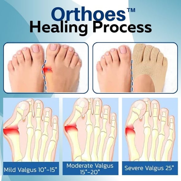 Ortopedske nogavice Orthoes™-SI