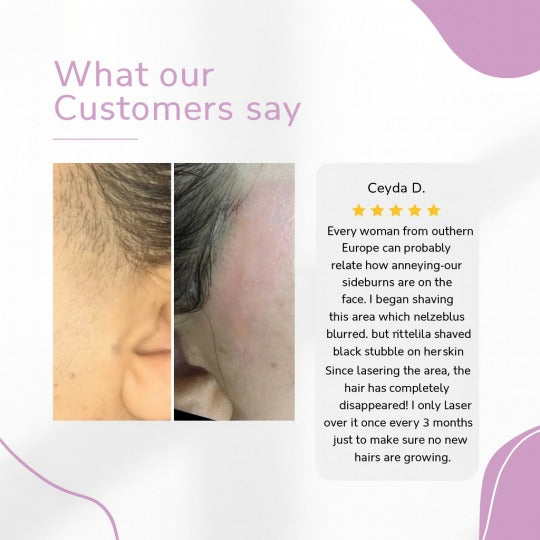 Naprava za odstranjevanje dlak Ylvis IPL – gladka koža brez dlak doma-SI