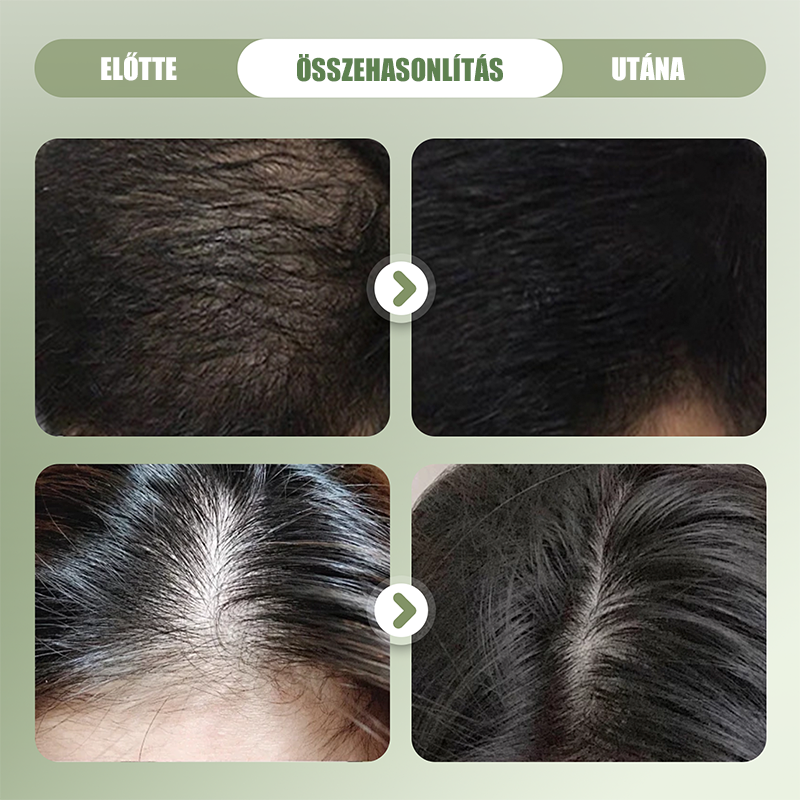 🌿 Natūralus šampūno batonėlis plaukų stiprinimui 🌱🥰-LT