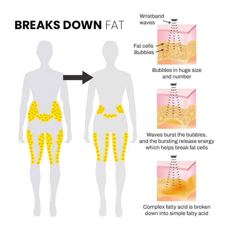 🔥ΤΕΛΕΥΤΑΙΑ ΜΕΡΑ - 70% ΕΚΠΤΩΣΗ) SlimolyTM Matteo Υπερηχητικό Βραχιόλι Body Shape Pro 🔥-GR
