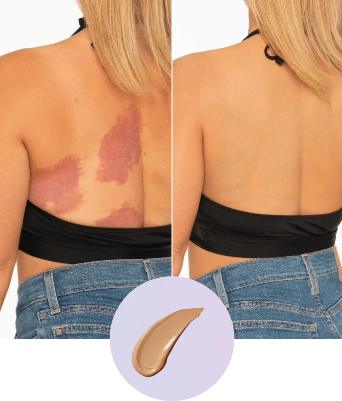 💜Paskutinė diena – pirkite 1, gaukite 1 nemokamai!💜✨Body Perfector – vandeniui atsparus, lengvas ir nepriekaištingas kūno makiažas-LT