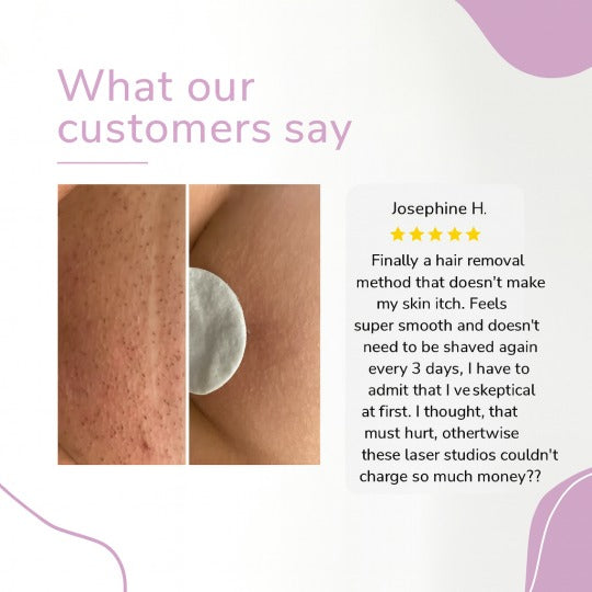 Naprava za odstranjevanje dlak Ylvis IPL – gladka koža brez dlak doma-SI