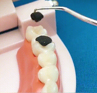 🦷Σετ οδοντογλυφίδων από ανοξείδωτο ατσάλι-GR