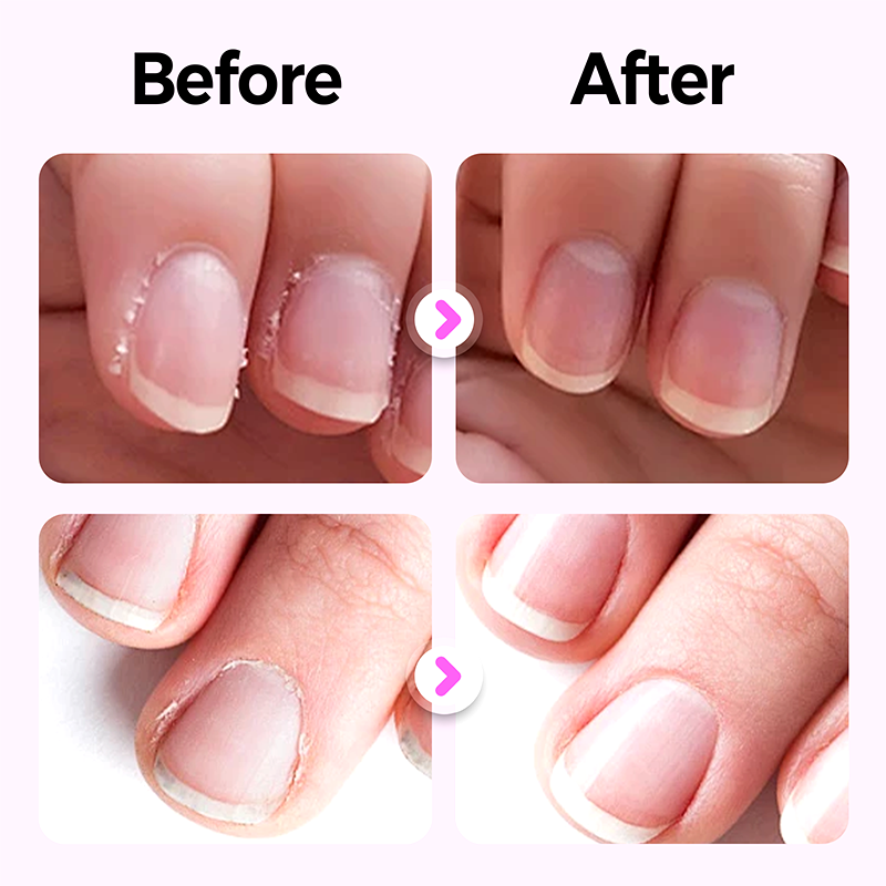 【Compra 1 y llévate 2 gratis】💜 Lápiz para decoración de uñas 3 en 1-ES