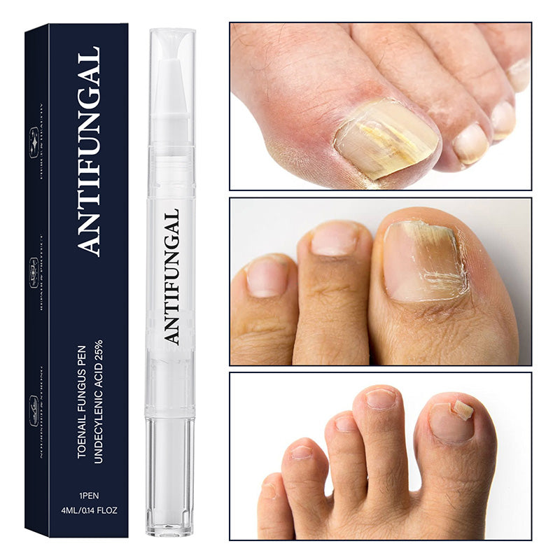 🔥Nagų grybelio gydymo pieštukas (pažeistiems nagams)-LT